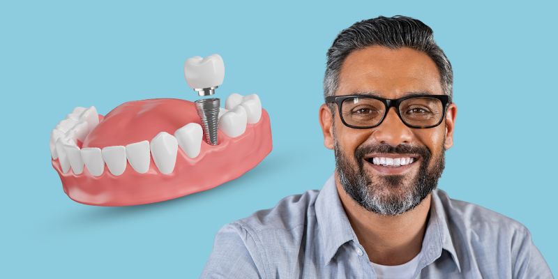 three day teeth fix