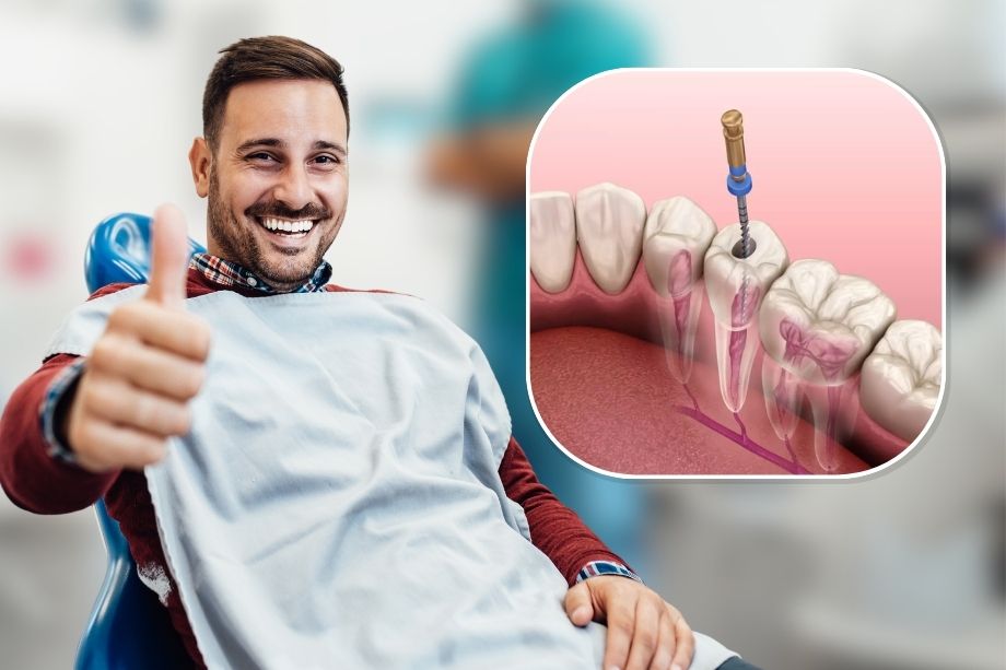 root canal procedure