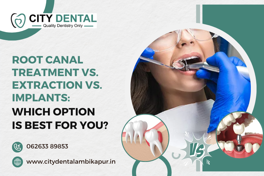 Root Canal Treatment vs. Extraction vs. Implants