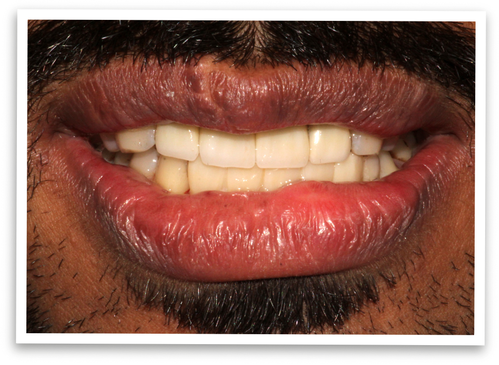 The-Power-of-a-Smile-Restored