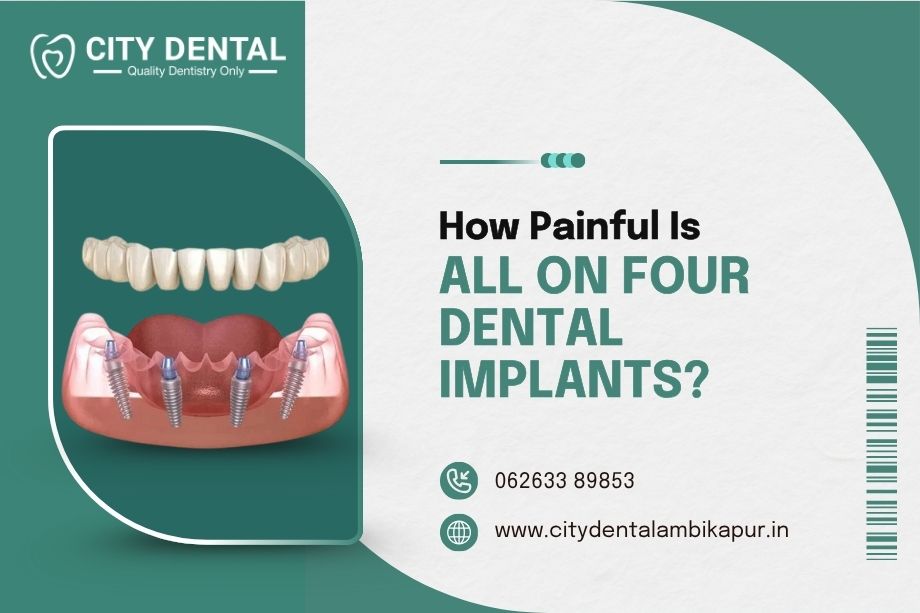 all on 4 implant in ambikapur