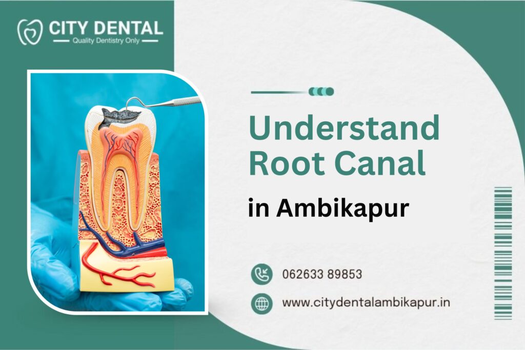 What Happens Inside Your Tooth During Root Canal? A Simple Guide