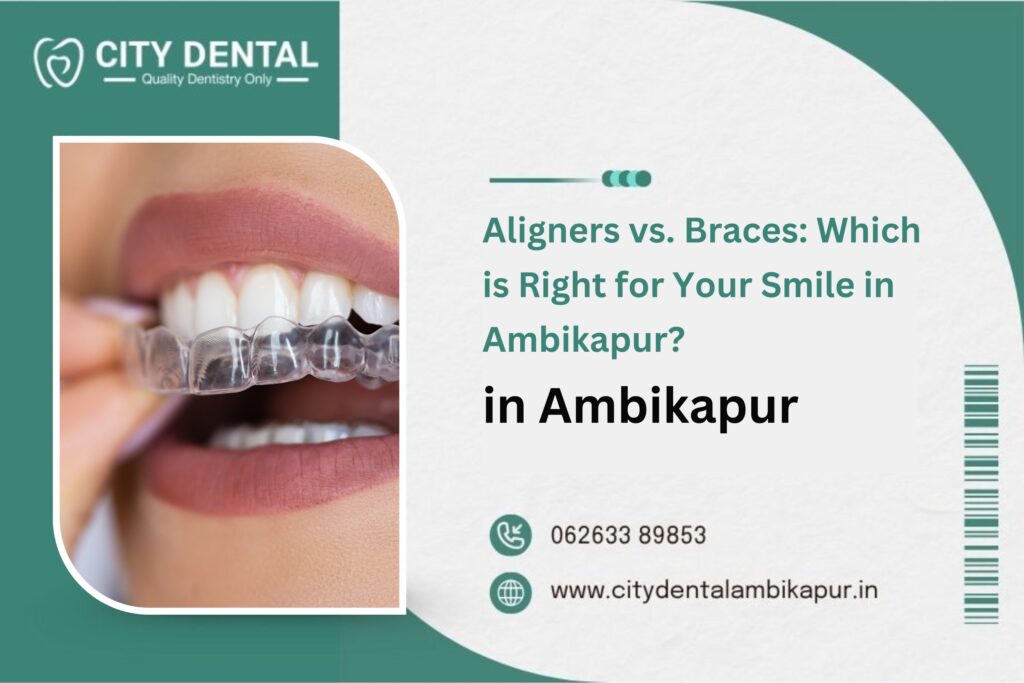 Aligners vs. Braces: Which is Right for Your Smile in Ambikapur?